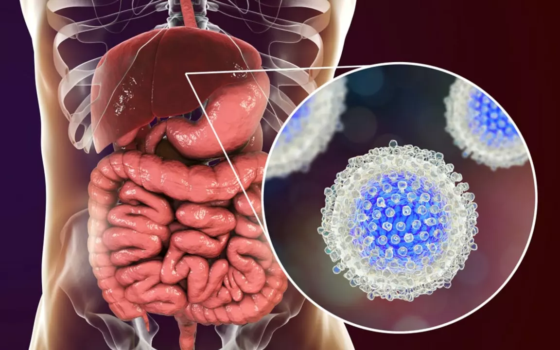 La conexión entre la Hepatitis C Crónica Genotipo 3 y los Trastornos Autoinmunes